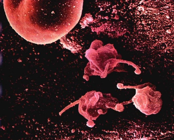 Возбудитель заболевания микоплазмоз под микроскопом
